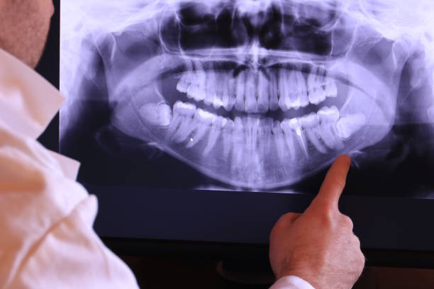 Best Emergency Treatment for Oral Infections in Manassas, VA